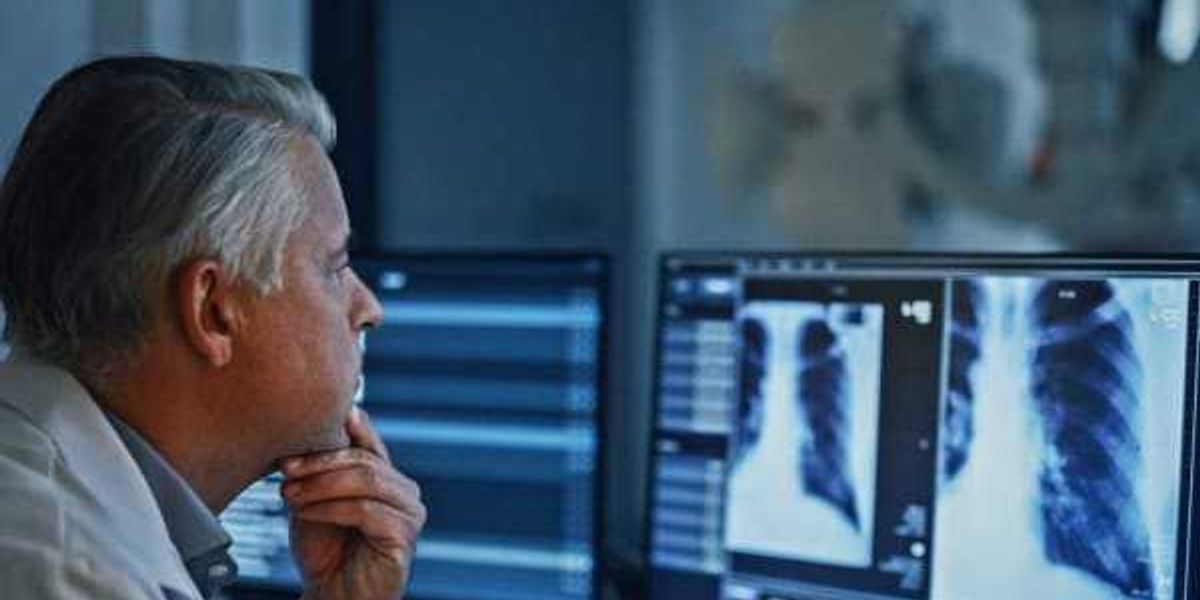 UT Well being San Antonio ranks amongst prime U.S. most cancers applications UT Well being San Antonio ranks amongst prime U.S. most cancers applications