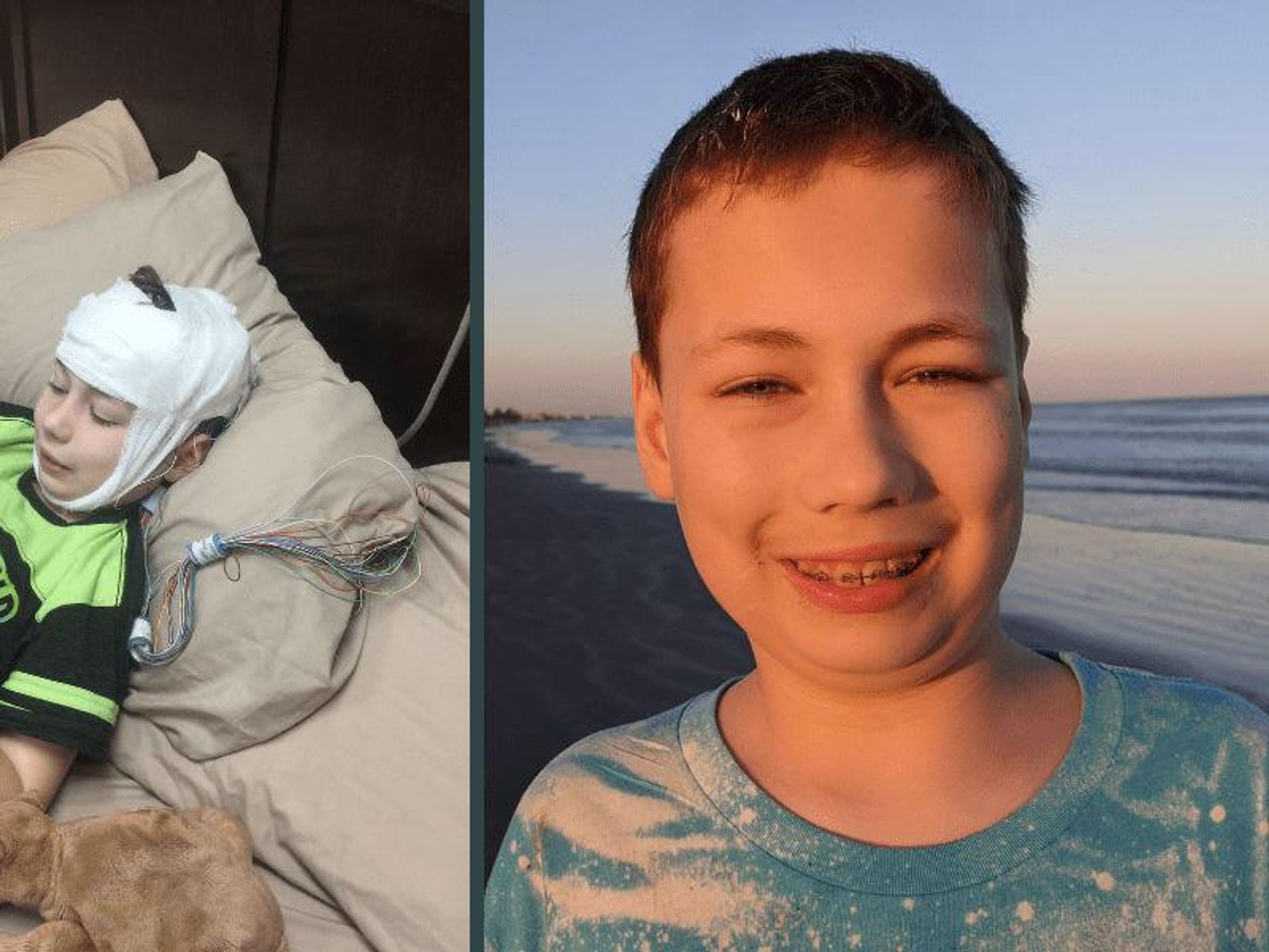 Medical marijuana from Texas Original enabled James to achieve two years seizure-free, and go from 22 oral seizure pills a day to zero.